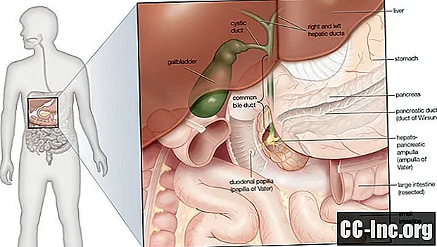 内視鏡的逆行性胆道膵管造影（ERCP）とは何ですか？