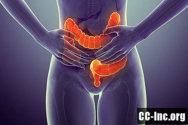 Los síntomas del cáncer de colon - Medicamento