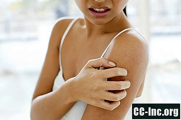 Symptome eines Ekzems (atopische Dermatitis)