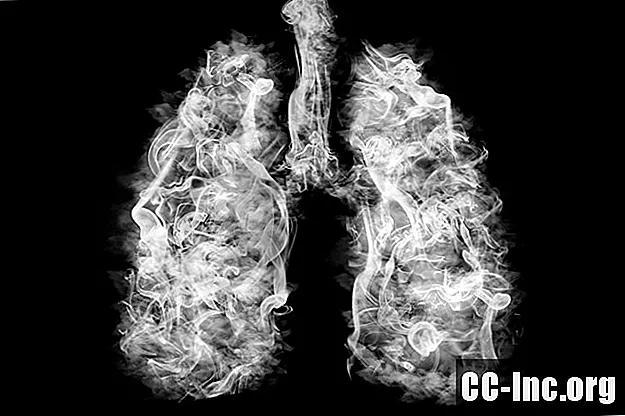 Symtom på lunginfektion vid KOL