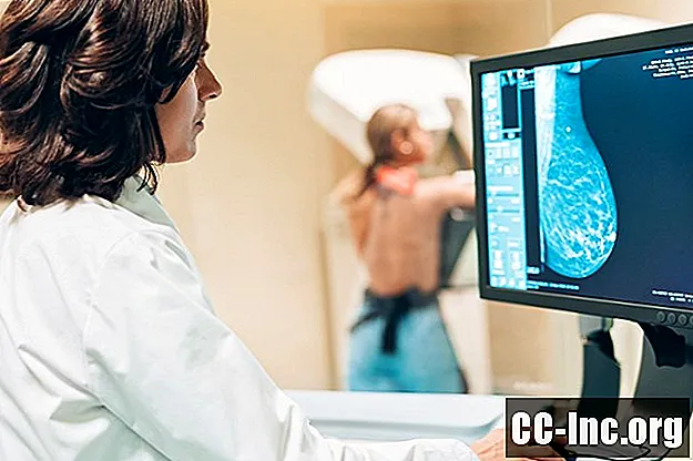 Objawy potrójnie ujemnego raka piersi - Medycyna