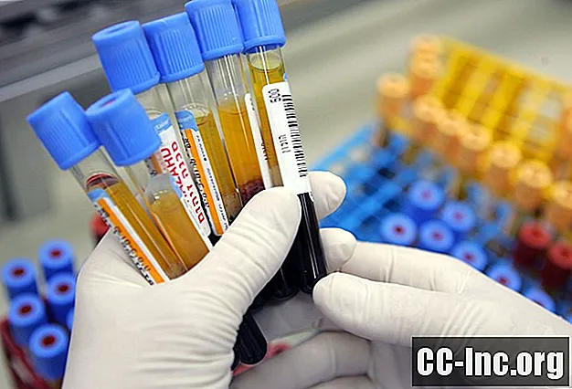 Fekaalse immunokeemiline test varjatud vere tuvastamiseks