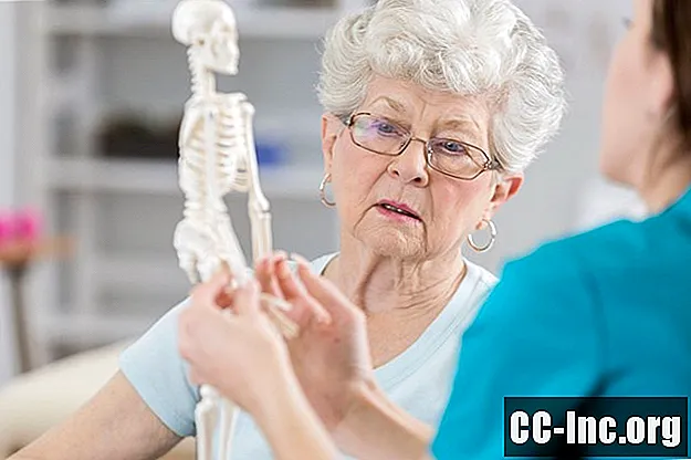Mengambil Evista untuk Osteoporosis