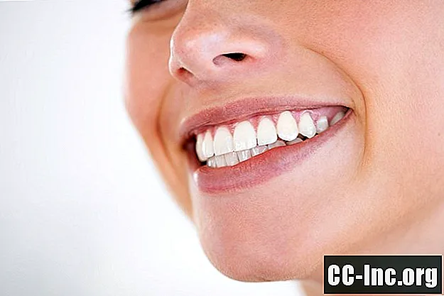 Maramice za zube: Oral-B četkice i alternative