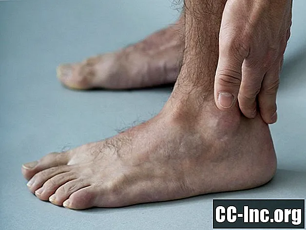 Sehnenentzündung des Fußes und des Sprunggelenks