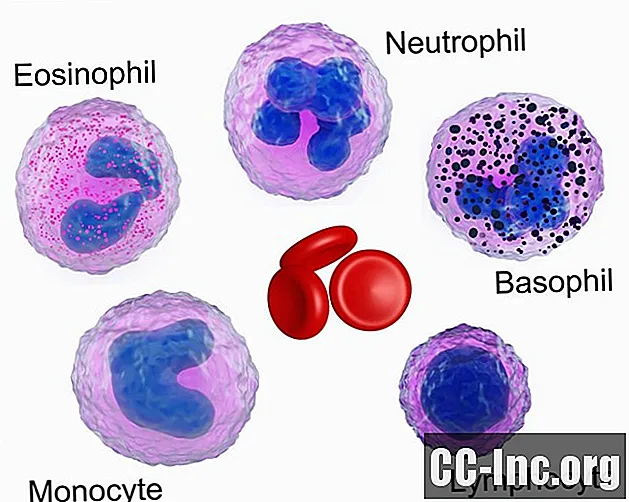 Les 8 types de néoplasmes myéloprolifératifs