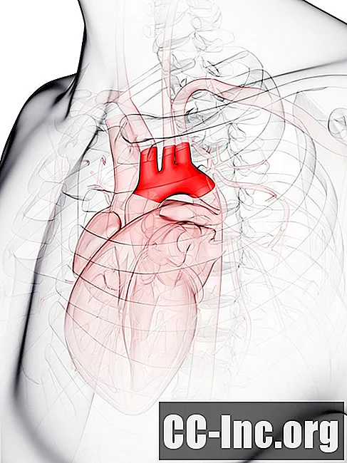 Die Anatomie des Aortenbogens