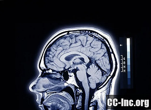 A anatomia da barreira sangue-cérebro - Medicamento