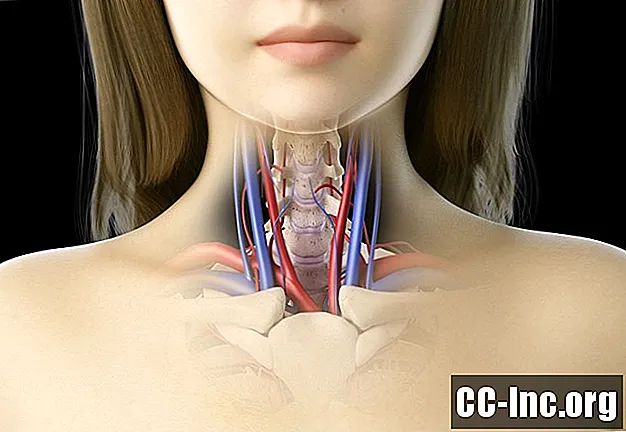 האנטומיה של עורק הצוואר