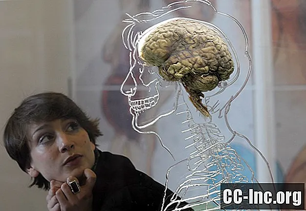 De anatomie van het cerebrum