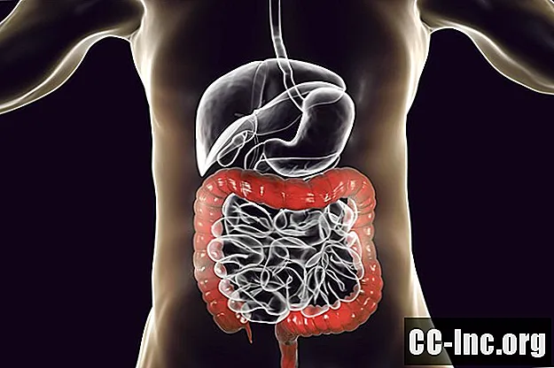 A anatomia do cólon (intestino grosso)