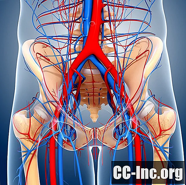 La anatomía de la arteria ilíaca común