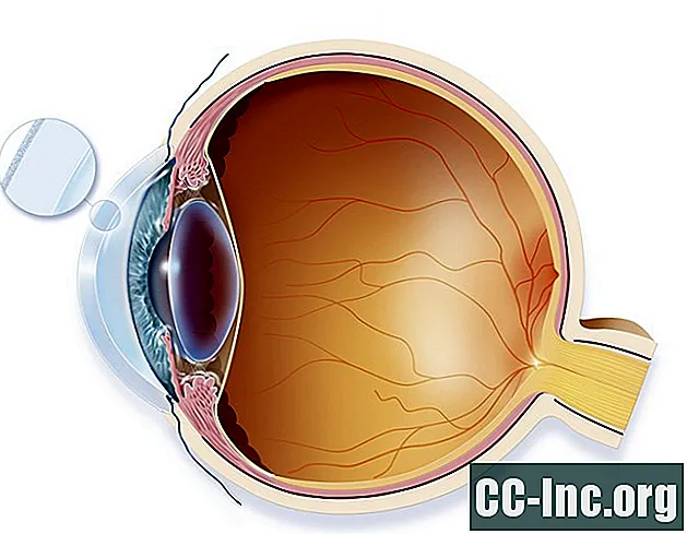 L'anatomia della cornea - Medicinale