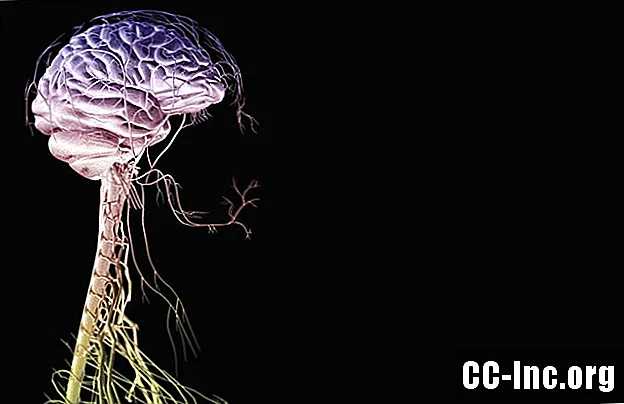 Die Anatomie der Hirnnerven