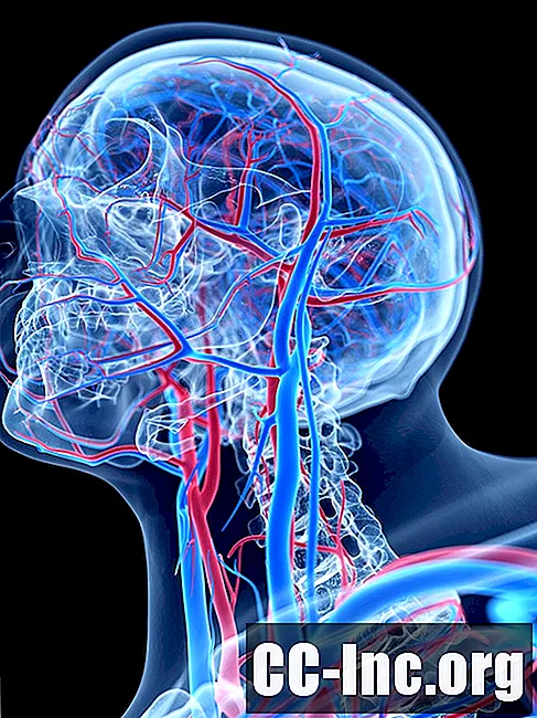 La anatomía de la arteria facial - Medicamento