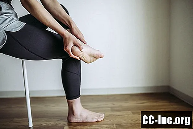 Pėdos anatomija ir bendros pėdos problemos