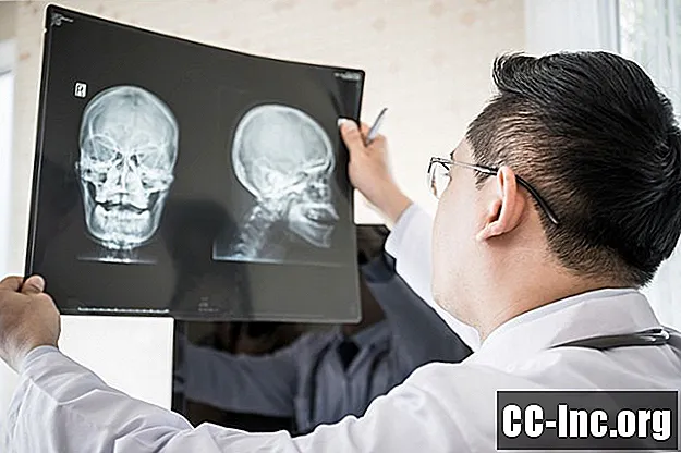 L'anatomie de l'os frontal
