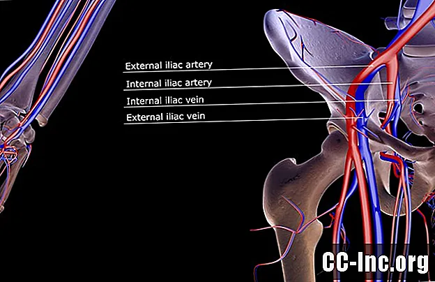 Anatomia arterei iliace interne
