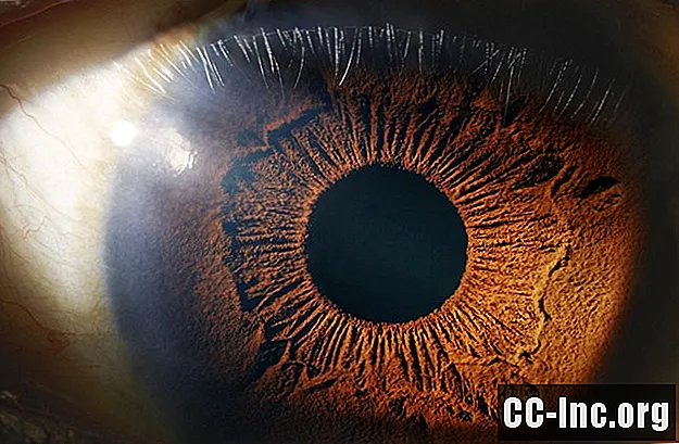 Giải phẫu của mống mắt