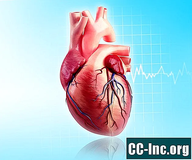 กายวิภาคของหลอดเลือดหัวใจด้านซ้าย