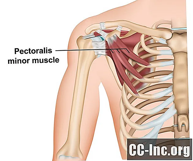 A anatomia do músculo peitoral menor