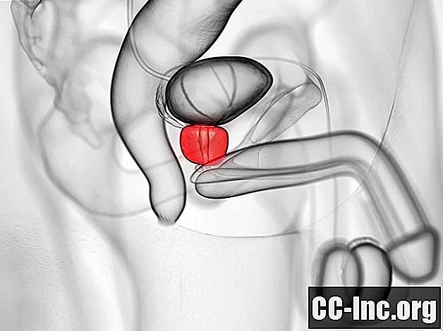 A anatomia da próstata