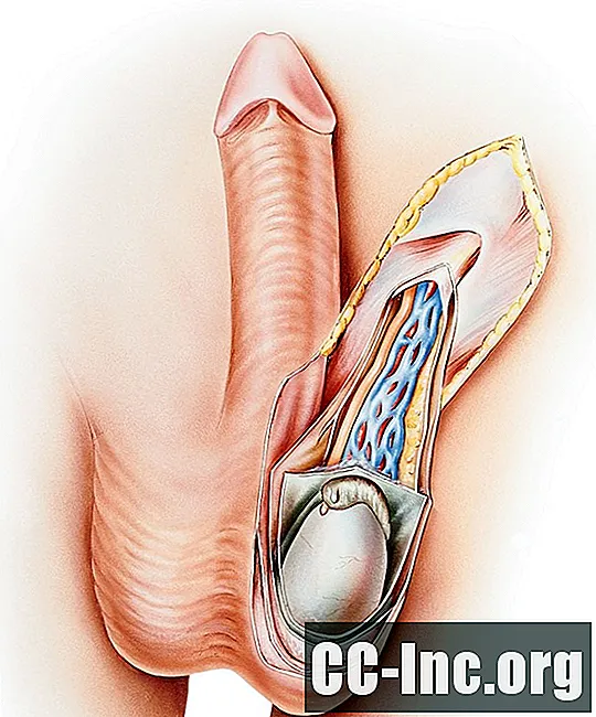 Anatomija mošnje