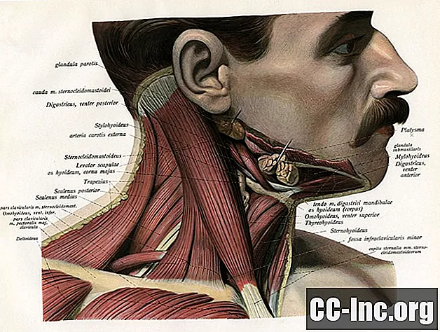 La anatomía del músculo esternocleidomastoideo