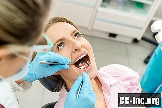 Fördelarna och riskerna med Dental Amalgam - Medicin