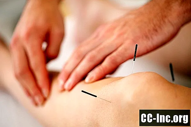 Fordelene og bivirkningene av akupunktur