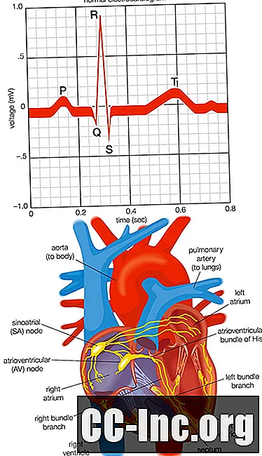 Det kardiale elektriske systemet og hvordan hjertet slår
