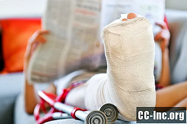 Les causes et le traitement des fractures de stress du pied et de la cheville
