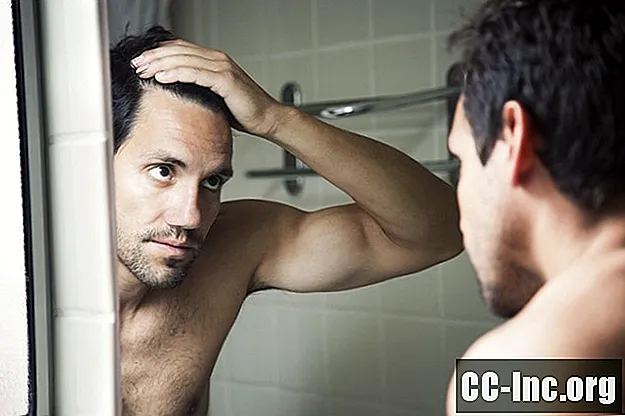 Las causas comunes de la pérdida excesiva de cabello en los hombres