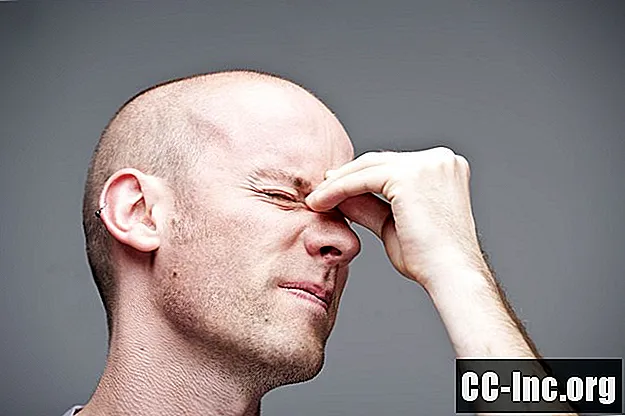 Forskjellen mellom migrene og sinus hodepine