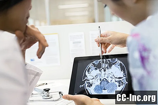 As diferenças entre demência cortical e subcortical