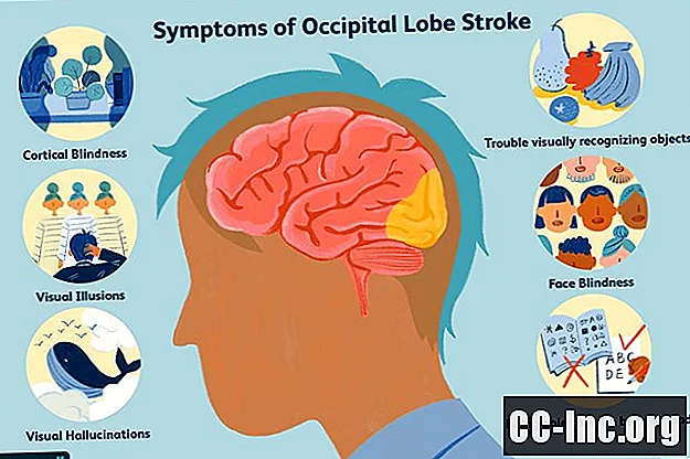 Los efectos de un accidente cerebrovascular en el lóbulo occipital - Medicamento