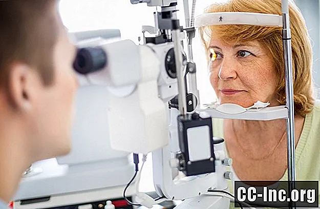 الرابط بين التهاب المفاصل ومشاكل العين