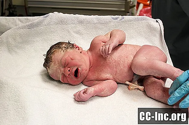 De vanligaste ortopediska skadorna hos nyfödda under förlossningen - Medicin