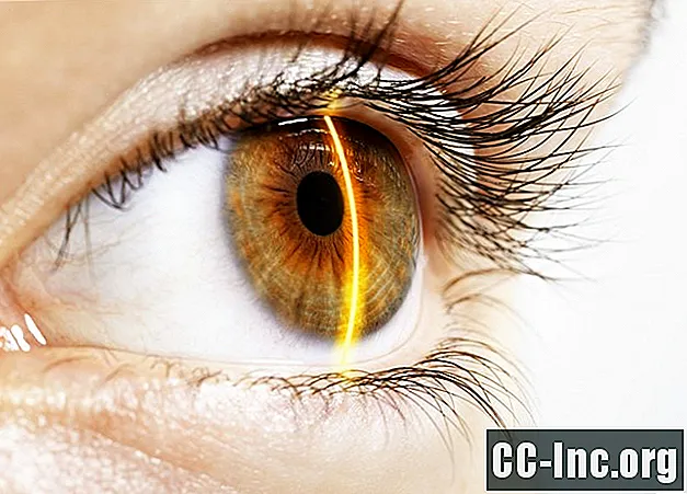 Chiasm Optik dan Bagaimana Ia Mempengaruhi Penglihatan