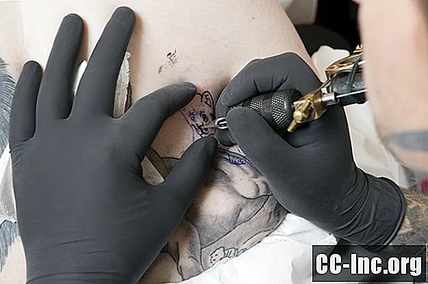 Viruksen hepatiitin riski tatuoinnilta