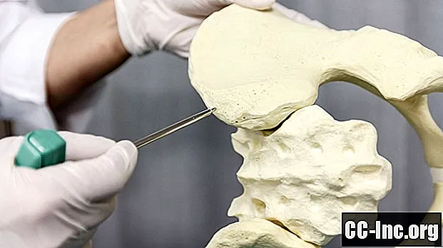 Risiko dan Kesan Sampingan Menderma Sumsum Tulang
