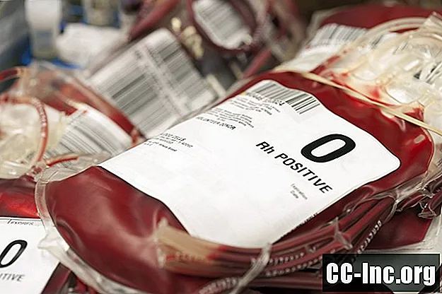 Ryzyko związane z transfuzjami krwi