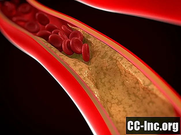 Улога артерија у циркулаторном систему