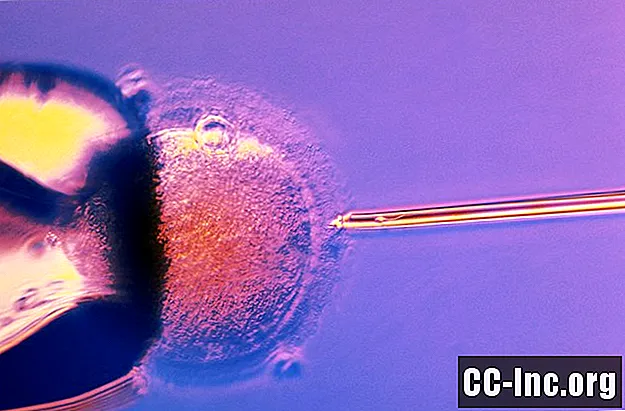 Πράγματα που πρέπει να γνωρίζετε προτού ξεκινήσετε την παρακολούθηση κατά τη διάρκεια ενός κύκλου εξωσωματικής γονιμοποίησης