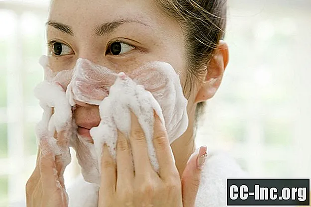 Tips voor het behandelen van acne en een vette huid