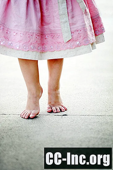 นิ้วเท้าเดินในเด็ก
