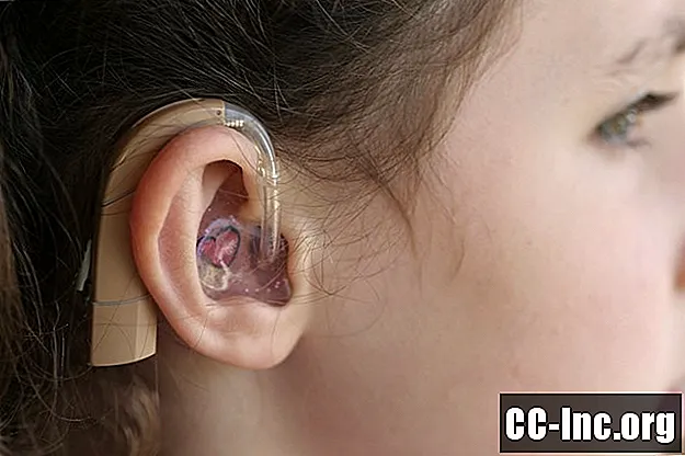 Sebab-sebab Teratas Kehilangan Pendengaran dan Pekak pada Kanak-kanak