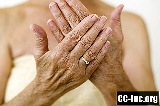 Aktuella krämer för smärtlindring av artrit - Medicin