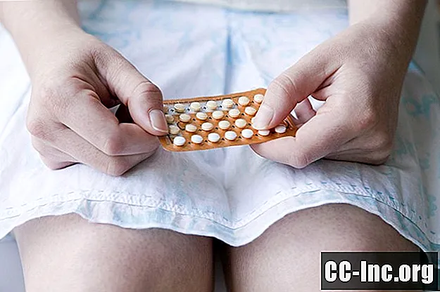 Ką daryti, jei praleidote kontraceptines tabletes