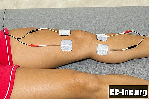 Видове електрическа стимулация, използвана във физиотерапията - Лекарство
